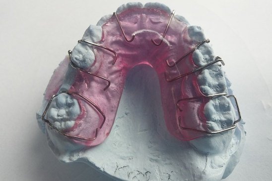 dental brace